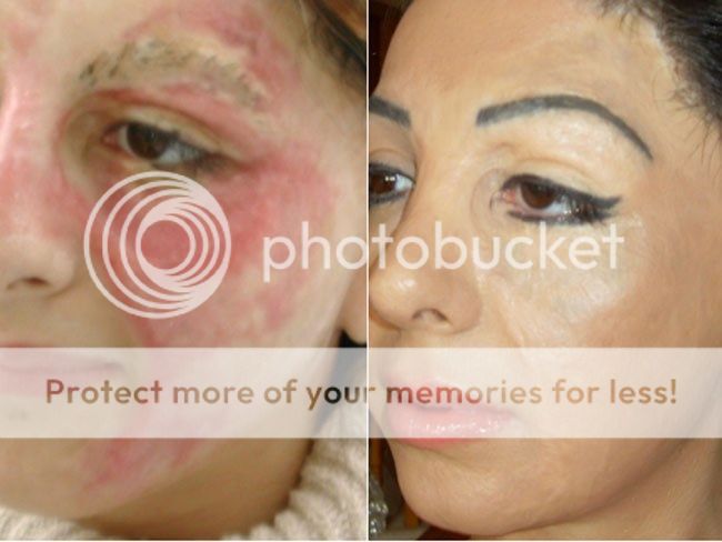  photo basma-hameed-before-after-cosmetic-tattoo - Copy_zpssd10kwje.jpg